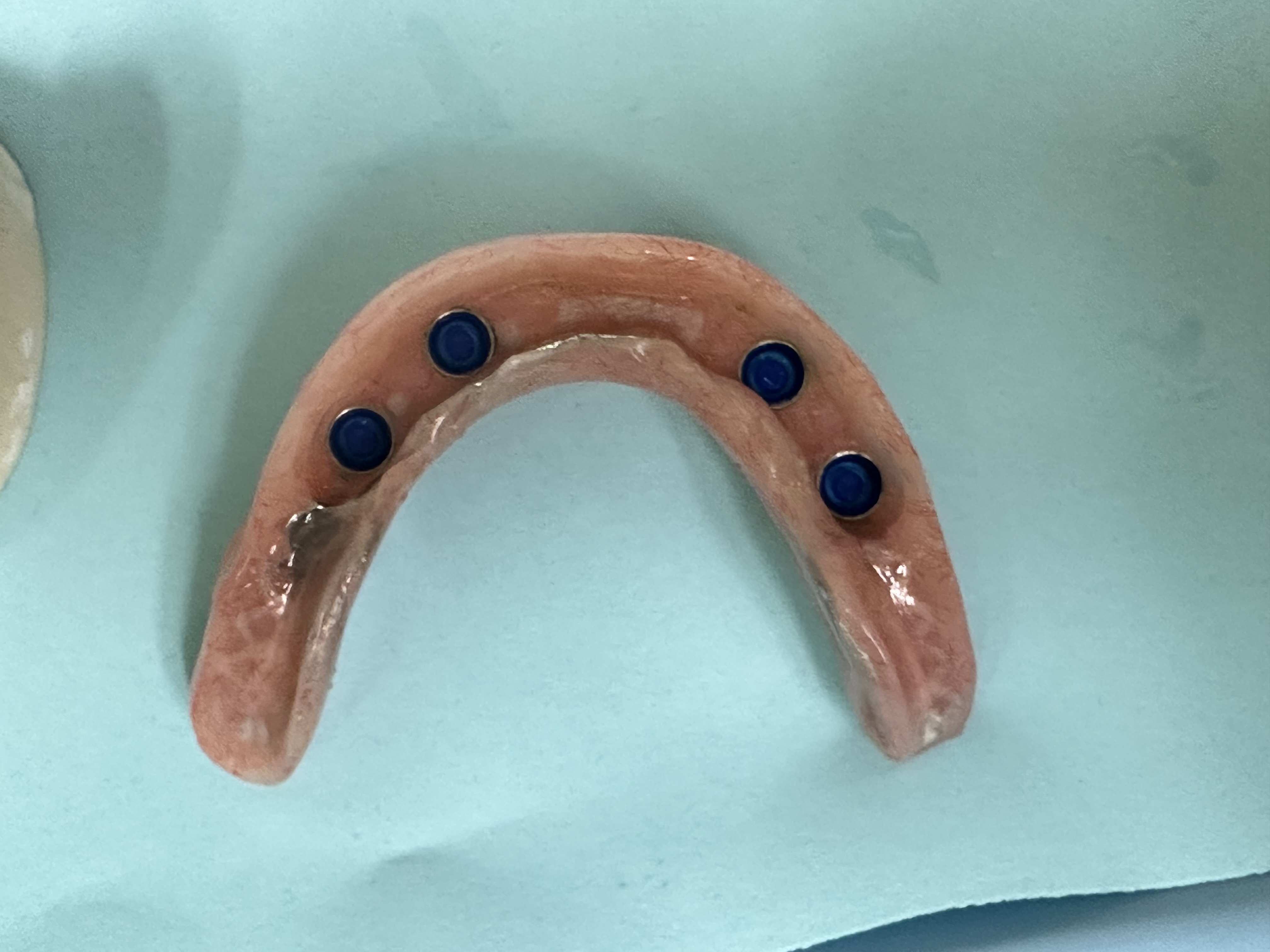 Denture base with locators